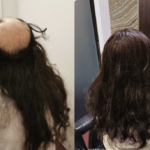 hairsg